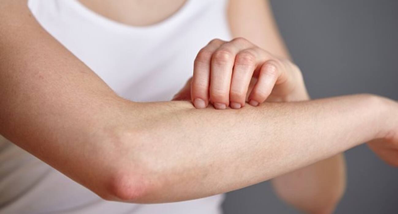 स्ट्रेस से हो सकती हैं ये 6 स्किन प्रॉब्लम्स