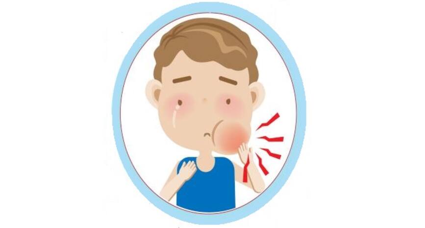 mumps disease clipart