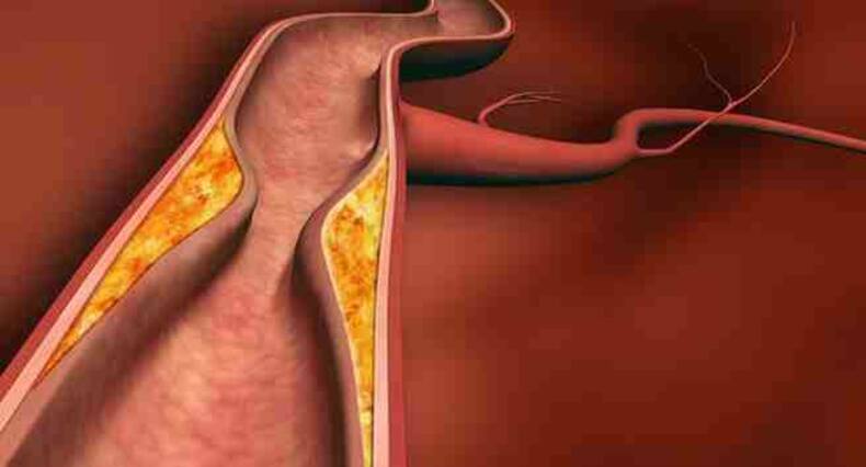 5 ways sitting for long can KILL the heart
