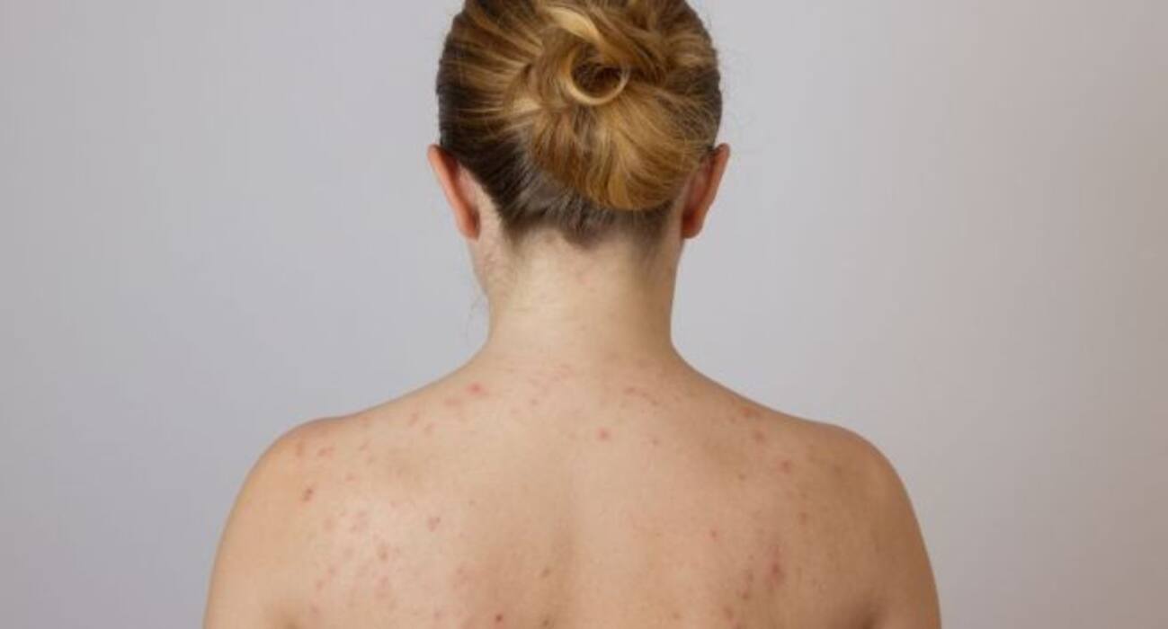 4 dangers of moisturisers you should know about