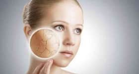 Pollution and sun damage drive demands for chemical peels
