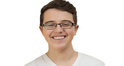 बच्चे को ब्रेसेस (Braces) लगवाने के पहले इन बातों का रखें ध्यान