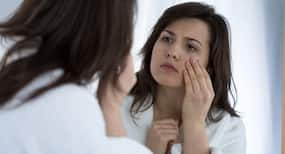 6 reasons why your eyes look puffy (apart from lack of sleep)