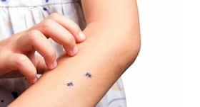 5 expert diet tips for chikungunya you should know!