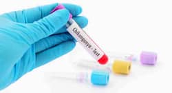 Chikungunya test and diagnosis – everything you need to know