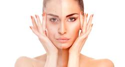 5 skin habits that clog your skin pores and cause acne
