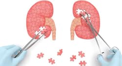 World Kidney Day: 3 basic tips for people on dialysis