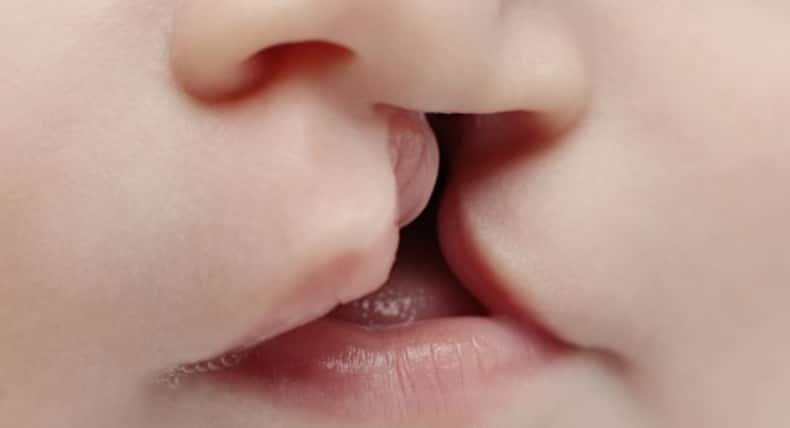 आंख, नाक, कान से जुड़ी 5 बीमारियां, जिनके कारण आती है सांस से बदबू