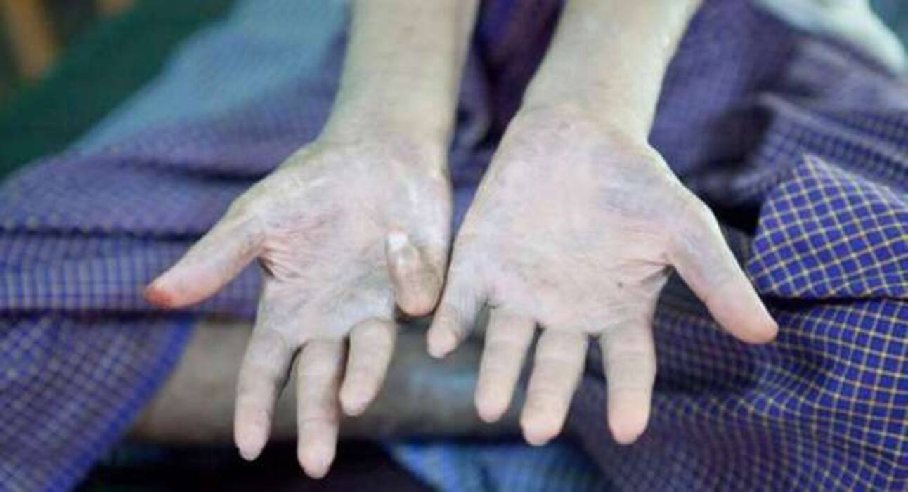 इन 8 कारणों से गिर सकते हैं आपकी भौंहों और पलकों के बाल