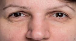 8 reasons for eyebrows thinning or eyebrow hair loss!