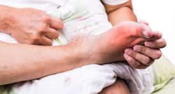 5 ways to stay hydrated and deal with gout