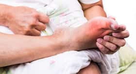 Dementia: Gout may up risk in elders
