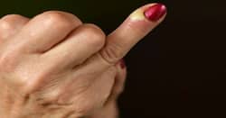 Pus formation – expert tips for home treatment