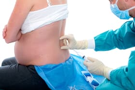 5 myths about epidural anaesthesia debunked