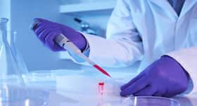 World Stroke Day: Everything you should know about stem cell therapy for stroke