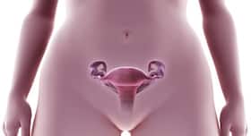 Daily dose of Aspirin may lower risk of ovarian cancer