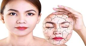 7 foods you MUST eat to heal insanely dry skin
