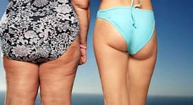 5 reasons you are putting on weight on your buttocks