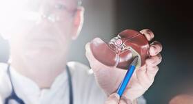 6 things that could go wrong with your liver (even without drinking alcohol)