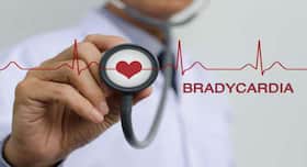 6 causes of bradycardia or decreased heart rate