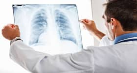 Chest X-ray -- everything you need to know