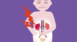 Kidney diseases in children - everything you need to know