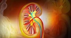 45 year old woman with ruptured and bleeding kidney tumour successfully treated at Fortis Hospital