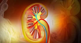 45 year old woman with ruptured and bleeding kidney tumour successfully treated at Fortis Hospital