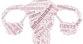 Know about these 5 natural remedies to treat PCOS
