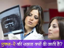 World Radiography Day: क्या गर्भवती X-ray करा सकती है? जानिए एक्‍स-रे से जुड़ी जरूरी बातें