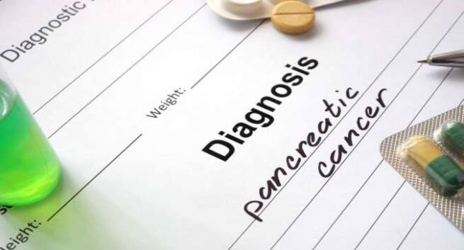 download diagnosing pancreatic cancer