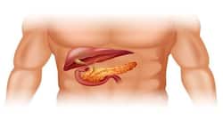 4 reasons pancreatic cancer is difficult to diagnose