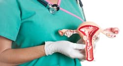 3-D printed ovaries may restore fertility in cancer survivors