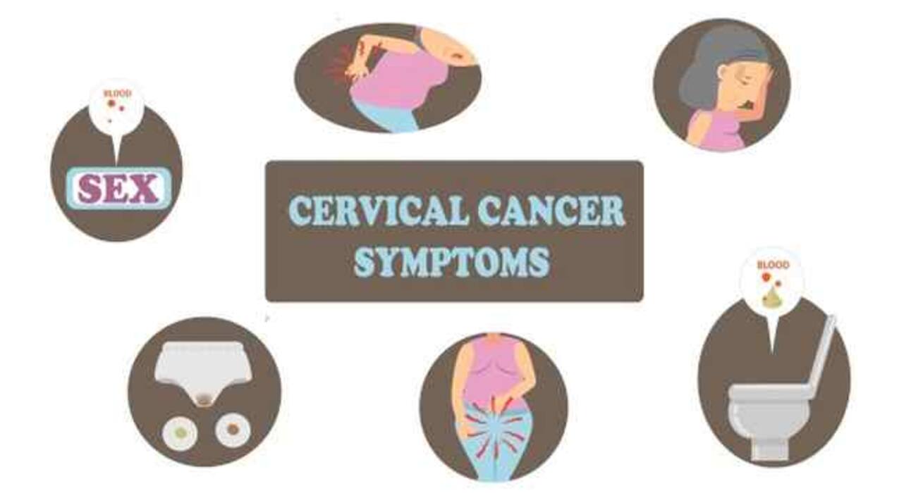 Cervical cancer in women -- 5 things every woman must know