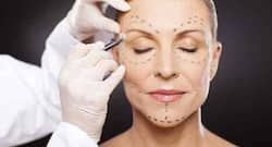 Facial Feminization Surgery Becoming Popular Among Transgender Women: What You Need To Know