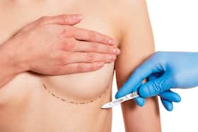 5 most popular celeb cosmetic surgeries in India 5 most popular celeb cosmetic surgeries in India