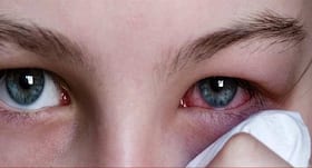 प्याज, एलोवेरा जैसी चीजों से पाए Conjunctivitis से राहत प्याज, एलोवेरा जैसी चीजों से पाए Conjunctivitis से राहत