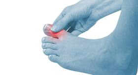 5 reasons your toes keep cramping and how you can prevent it!