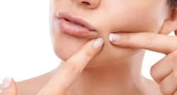 6 types of bumps you should NEVER squeeze or pop