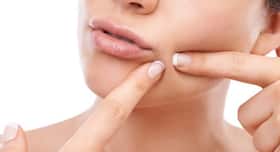 6 types of bumps you should NEVER squeeze or pop