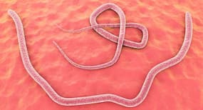 Shocking! Hookworms suck 22 liters of blood from the small intestine of a boy