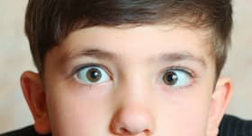How can I treat my lazy eye (query)