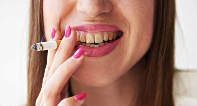 Why You Should Not Ignore Staining Of Teeth Thehealthsite Com