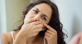 What should you do after popping a zit to prevent scarring?