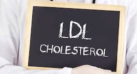 Check your cholesterol regularly after a heart attack