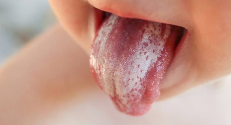5 gross things that happen when you don't clean your tongue