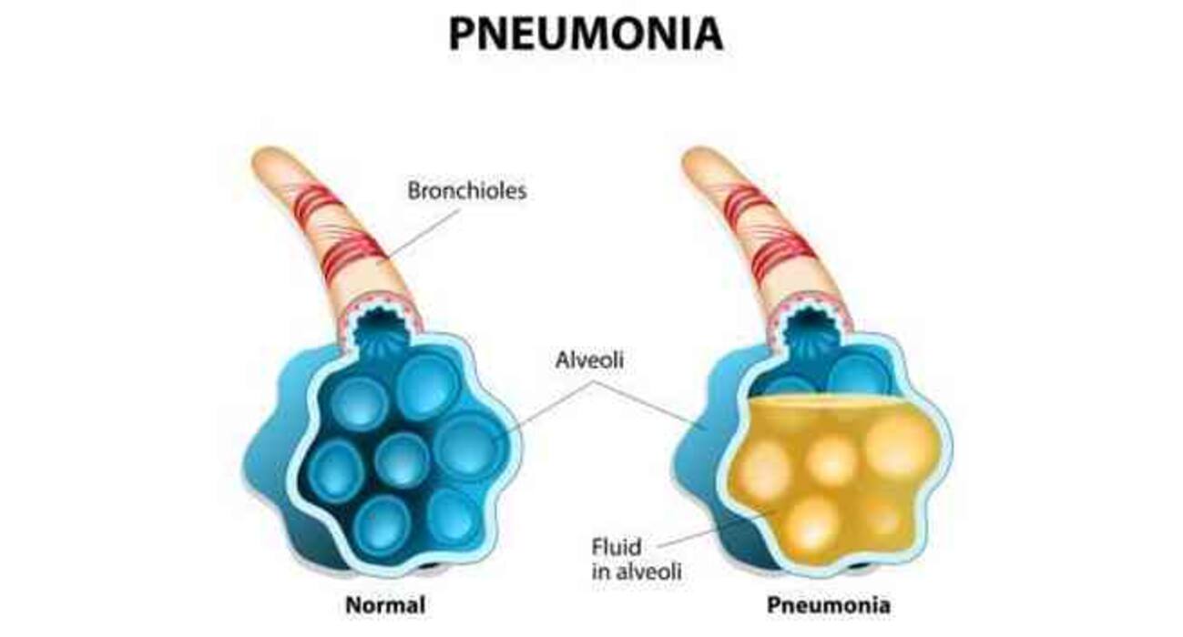 7 reasons you should not IGNORE chronic cold