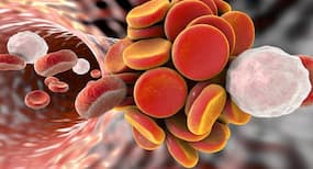 5 signs you might have a blood clot 5 signs you might have a blood clot