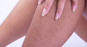 What the changes in body hair says about your health?