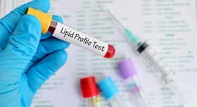 4 conditions that show high triglycerides (but normal LDL cholesterol)